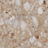 Centura - ETOILE - Carreau de céramique - TROPICAL NATURAL 24 po x 48 po x 10 mm