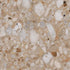 Centura - VENISTONE - Ceramic Tile - GOLD natural 36 in x 36 in x 10 mm